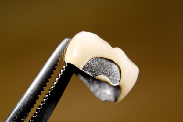 What To Do When You Damage A Dental Crown