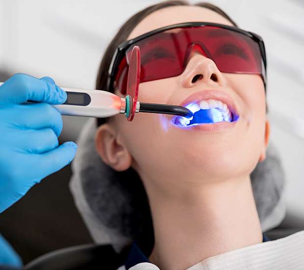 Owensboro Professional Teeth Whitening